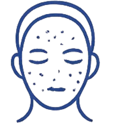 Acne Scars | Dermionic Technologies