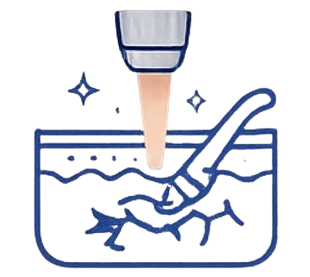 Tatto removal | Dermionic Technologies