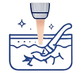 Tatto removal | Dermionic Technologies Tatto removal | Dermionic Technologies Pakistan